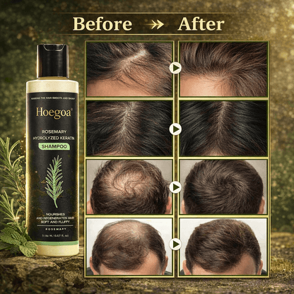 Hoegaon Rosemary Shampoo bottle with 'Before' and 'After' hair transformation images on a wooden background.